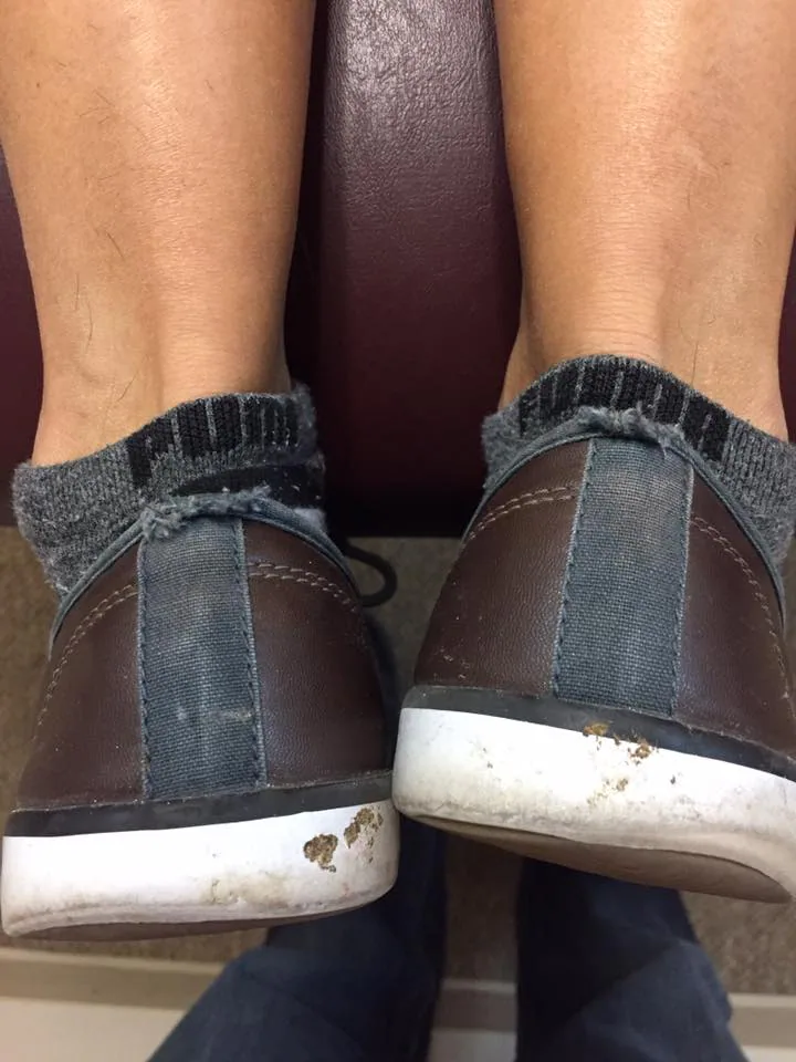 crooked brown feet